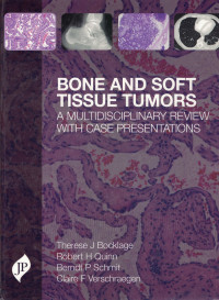 Image of Bone and Soft Tissue Tumors