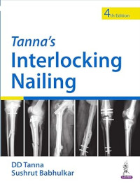 Image of Tanna’s Interlocking Nailing
