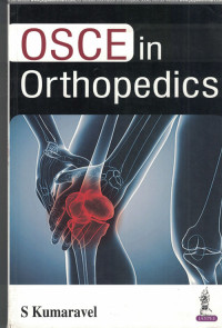Image of OSCE in Orthopedics